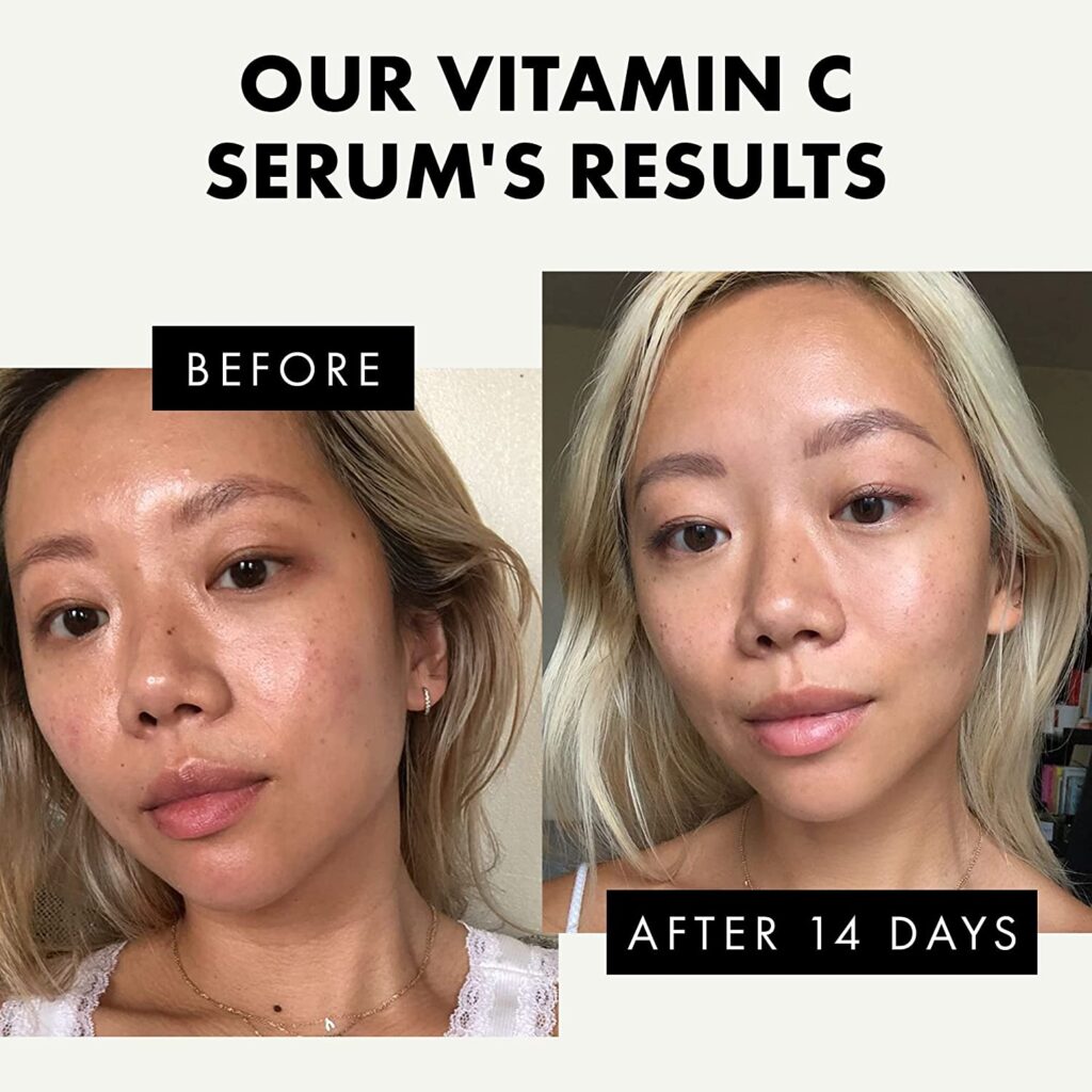 Vitamin c serum Results