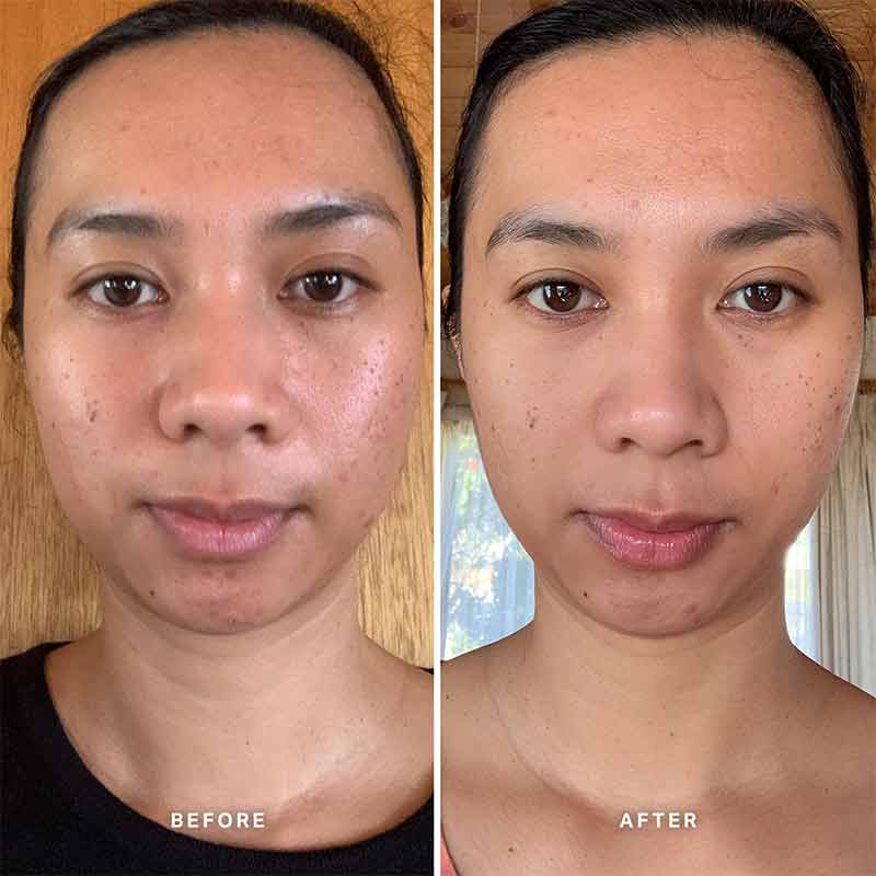vitamin c Serum before and after